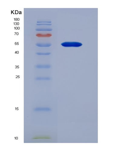 SDS-PAGE analysis of Human WARS1 (Tryptophan--Trna Ligase, Cytoplasmic) - Recombinant Protein, CAT# BLT-04593P, showing >95% purity under 15% SDS-PAGE (Reduced)Human WARS1 (Tryptophan--Trna Ligase, Cytoplasmic) - Recombinant Protein