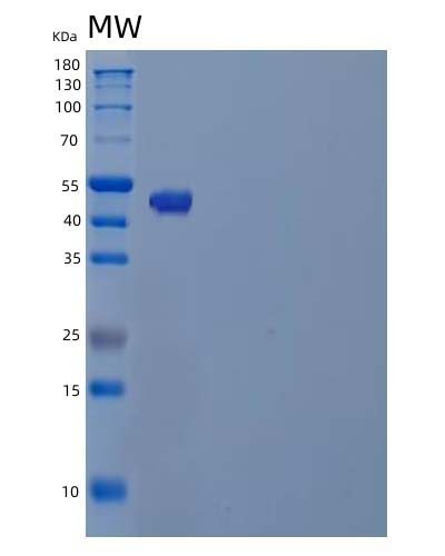 SDS-PAGE analysis of Human TUBB4A (Tubulin Beta-4A Chain) - Recombinant Protein, CATHuman TUBB4A (Tubulin Beta-4A Chain) - Recombinant Protein
