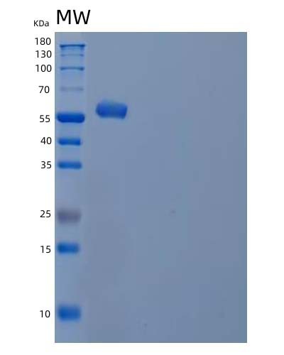SDS-PAGE analysis of Human IRF5 (Interferon Regulatory Factor 5) - Recombinant Protein, CAT# BLT-04618P, showing >90% purity under 15% SDS-PAGE (Reduced)Human IRF5 (Interferon Regulatory Factor 5) - Recombinant Protein
