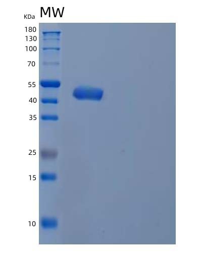 SDS-PAGE analysis of Human INPP5A (Inositol Polyphosphate-5-Phosphatase A) - Recombinant Protein, CAT# BLT-04621P, showing >90% purity under 15% SDS-PAGE (Reduced)Human INPP5A (Inositol Polyphosphate-5-Phosphatase A) - Recombinant Protein