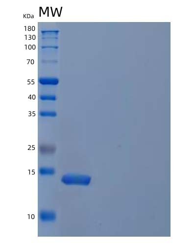 SDS-PAGE analysis of Mouse Il21 (Interleukin-21) - Recombinant Protein, CAT# BLT-04622P, showing >85% purity under 15% SDS-PAGE (Reduced)Mouse Il21 (Interleukin-21) - Recombinant Protein
