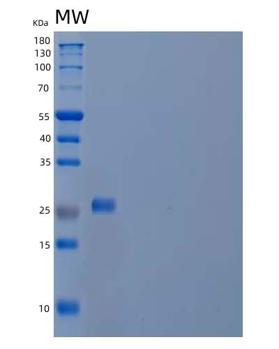 SDS-PAGE analysis of Human ACRV1 (Acrosomal Protein Sp-10) - Recombinant Protein, CAT# BLT-04633P, showing >90% purity under 15% SDS-PAGE (Reduced)Human ACRV1 (Acrosomal Protein Sp-10) - Recombinant Protein