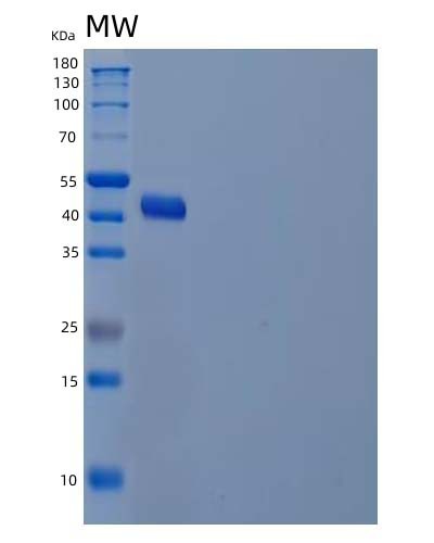 SDS-PAGE analysis of Human ADH7 (All-Trans-Retinol Dehydrogenase [Nad(+)] Adh7) - Recombinant Protein, CAT# BLT-04667P, showing >85% purity under 15% SDS-PAGE (Reduced)Human ADH7 (All-Trans-Retinol Dehydrogenase [Nad(+)] Adh7) - Recombinant Protein