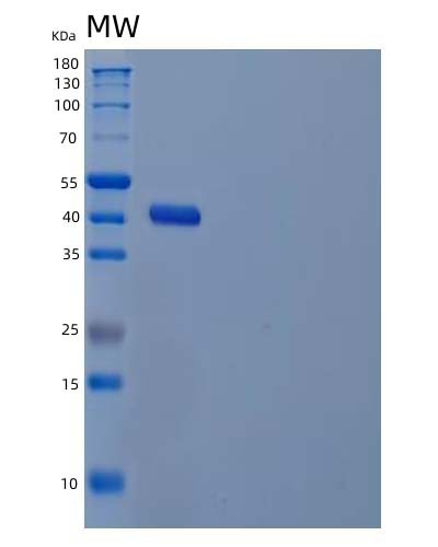 SDS-PAGE analysis of Human GALE (Udp-Glucose 4-Epimerase) - Recombinant Protein, CATHuman GALE (Udp-Glucose 4-Epimerase) - Recombinant Protein