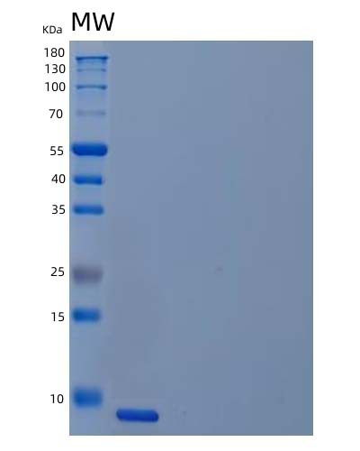 SDS-PAGE analysis of Human UCMA (Unique Cartilage Matrix-Associated Protein) - Recombinant Protein, CATHuman UCMA (Unique Cartilage Matrix-Associated Protein) - Recombinant Protein
