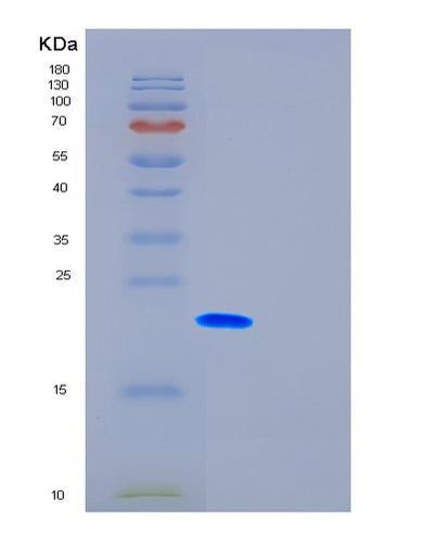 SDS-PAGE analysis of Human FTH1 (Ferritin Heavy Chain) - Recombinant Protein, CAT# BLT-01115P, showing >85% purity under 15% SDS-PAGE (Reduced)Human FTH1 (Ferritin Heavy Chain) - Recombinant Protein