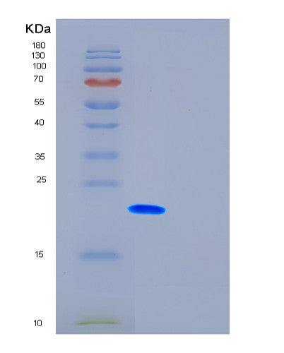 SDS-PAGE analysis of Human FTH1 (Ferritin Heavy Chain) - Recombinant Protein, CATHuman FTH1 (Ferritin Heavy Chain) - Recombinant Protein