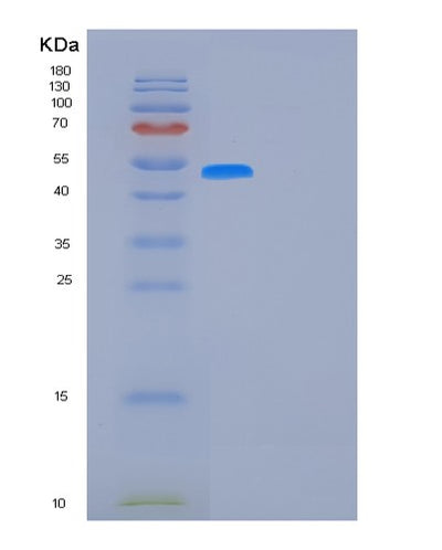 SDS-PAGE analysis of Human FUCA1 (Tissue Alpha-L-Fucosidase) - Recombinant Protein, CAT# BLT-01119P, showing >95% purity under 15% SDS-PAGE (Reduced)Human FUCA1 (Tissue Alpha-L-Fucosidase) - Recombinant Protein