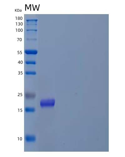 SDS-PAGE analysis of Human PFDN4 (Prefoldin Subunit 4) - Recombinant Protein, CAT# BLT-04702P, showing >90% purity under 15% SDS-PAGE (Reduced)Human PFDN4 (Prefoldin Subunit 4) - Recombinant Protein