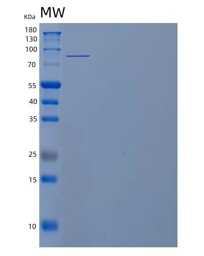 SDS-PAGE analysis of Human ACE2 (Angiotensin-Converting Enzyme 2) - Recombinant Protein, CAT# BLT-04710P, showing >95% purity under 15% SDS-PAGE (Reduced)Human ACE2 (Angiotensin-Converting Enzyme 2) - Recombinant Protein