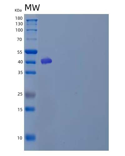 SDS-PAGE analysis of Human B4GALT3 (Beta-1,4-Galactosyltransferase 3) - Recombinant Protein, CAT# BLT-04822P, showing >90% purity under 15% SDS-PAGE (Reduced)Human B4GALT3 (Beta-1,4-Galactosyltransferase 3) - Recombinant Protein