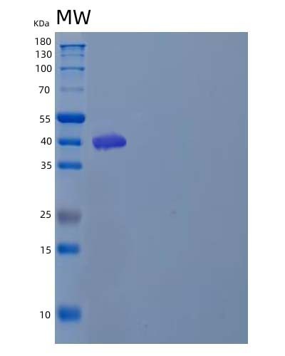SDS-PAGE analysis of Human CD47 (Leukocyte Surface Antigen Cd47) - Recombinant Protein, CAT# BLT-04835P, showing >85% purity under 15% SDS-PAGE (Reduced)Human CD47 (Leukocyte Surface Antigen Cd47) - Recombinant Protein