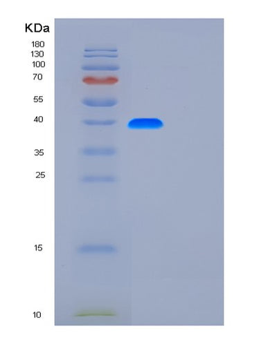 SDS-PAGE analysis of Human FUT3 (3-Galactosyl-N-Acetylglucosaminide 4-Alpha-L-Fucosyltransferase Fut3) - Recombinant Protein, CAT# BLT-01123P, showing >90% purity under 15% SDS-PAGE (Reduced)Human FUT3 (3-Galactosyl-N-Acetylglucosaminide 4-Alpha-L-Fucosyltransferase Fut3) - Recombinant Protein