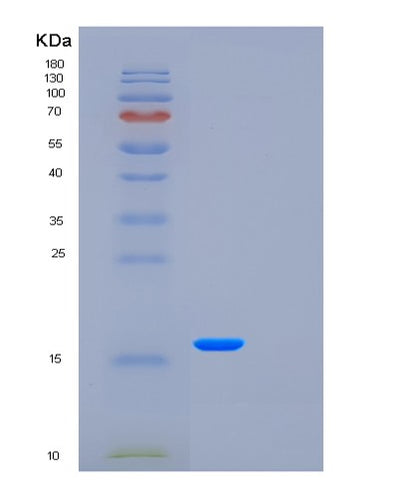 SDS-PAGE analysis of Human FXYD5 (Fxyd Domain-Containing Ion Transport Regulator 5) - Recombinant Protein, CAT# BLT-01125P, showing >95% purity under 15% SDS-PAGE (Reduced)Human FXYD5 (Fxyd Domain-Containing Ion Transport Regulator 5) - Recombinant Protein