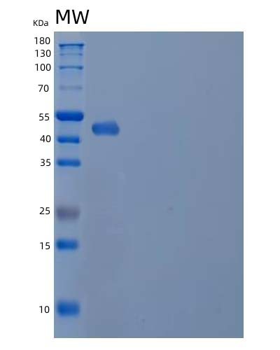 SDS-PAGE analysis of Human MGAT2 (Alpha-1,6-Mannosyl-Glycoprotein 2-Beta-N-Acetylglucosaminyltransferase) - Recombinant Protein, CAT# BLT-04892P, showing >85% purity under 15% SDS-PAGE (Reduced)Human MGAT2 (Alpha-1,6-Mannosyl-Glycoprotein 2-Beta-N-Acetylglucosaminyltransferase) - Recombinant Protein