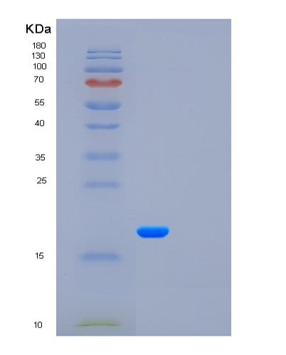 SDS-PAGE analysis of Human CSF3 (Granulocyte Colony-Stimulating Factor) - Recombinant Protein, CATHuman CSF3 (Granulocyte Colony-Stimulating Factor) - Recombinant Protein