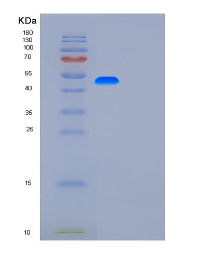 SDS-PAGE analysis of Human G3BP1 (Ras Gtpase-Activating Protein-Binding Protein 1) - Recombinant Protein, CAT# BLT-01127P, showing >85% purity under 15% SDS-PAGE (Reduced)Human G3BP1 (Ras Gtpase-Activating Protein-Binding Protein 1) - Recombinant Protein