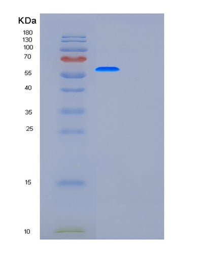 SDS-PAGE analysis of Human G6PD (Glucose-6-Phosphate 1-Dehydrogenase) - Recombinant Protein, CAT# BLT-01129P, showing >90% purity under 15% SDS-PAGE (Reduced)Human G6PD (Glucose-6-Phosphate 1-Dehydrogenase) - Recombinant Protein