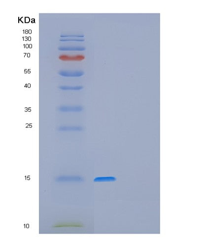 SDS-PAGE analysis of Human GAGE12F (G Antigen 12F) - Recombinant Protein, CATHuman GAGE12F (G Antigen 12F) - Recombinant Protein