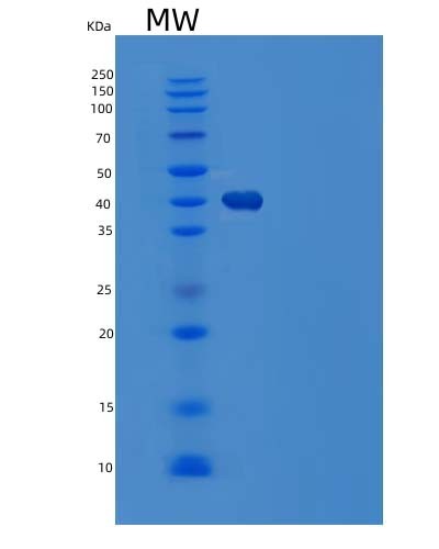 SDS-PAGE analysis of Mouse Lgmn (Legumain) - Recombinant Protein, CAT# BLT-04930P, showing >90% purity under 15% SDS-PAGE (Reduced)Mouse Lgmn (Legumain) - Recombinant Protein