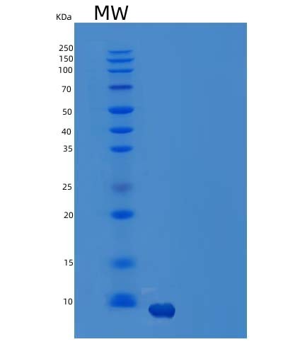 SDS-PAGE analysis of Human CCL14 (C-C Motif Chemokine 14) - Recombinant Protein, CAT# BLT-04931P, showing >85% purity under 15% SDS-PAGE (Reduced)Human CCL14 (C-C Motif Chemokine 14) - Recombinant Protein