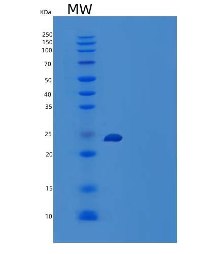 SDS-PAGE analysis of Human MUC15 (Mucin-15) - Recombinant Protein, CAT# BLT-04944P, showing >95% purity under 15% SDS-PAGE (Reduced)Human MUC15 (Mucin-15) - Recombinant Protein