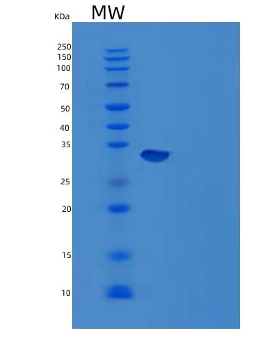 SDS-PAGE analysis of Mouse Ca12 (Carbonic Anhydrase 12) - Recombinant Protein, CAT# BLT-04953P, showing >95% purity under 15% SDS-PAGE (Reduced)Mouse Ca12 (Carbonic Anhydrase 12) - Recombinant Protein