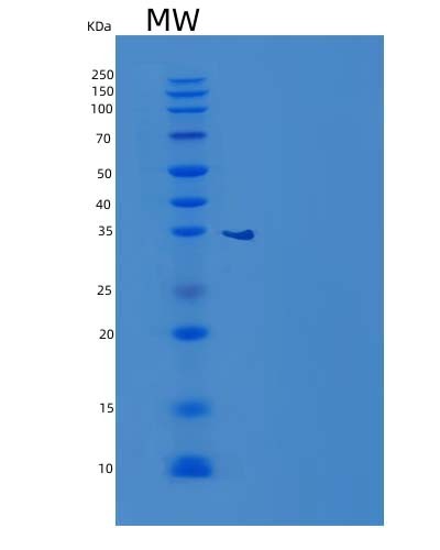 SDS-PAGE analysis of Human GNMT (Glycine N-Methyltransferase) - Recombinant Protein, CATHuman GNMT (Glycine N-Methyltransferase) - Recombinant Protein