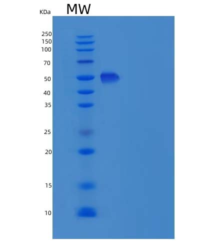 SDS-PAGE analysis of Mouse Icam2 (Intercellular Adhesion Molecule 2) - Recombinant Protein, CAT# BLT-05010P, showing >90% purity under 15% SDS-PAGE (Reduced)Mouse Icam2 (Intercellular Adhesion Molecule 2) - Recombinant Protein