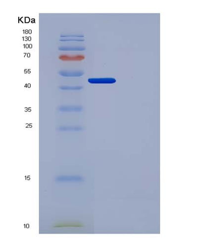 SDS-PAGE analysis of Human PLAU (Urokinase-Type Plasminogen Activator) - Recombinant Protein, CAT# BLT-05013P, showing >90% purity under 15% SDS-PAGE (Reduced)Human PLAU (Urokinase-Type Plasminogen Activator) - Recombinant Protein