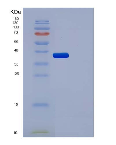 SDS-PAGE analysis of Human AKR1A1 (Aldo-Keto Reductase Family 1 Member A1) - Recombinant Protein, CAT# BLT-05015P, showing >95% purity under 15% SDS-PAGE (Reduced)Human AKR1A1 (Aldo-Keto Reductase Family 1 Member A1) - Recombinant Protein