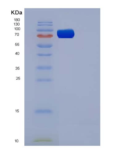 SDS-PAGE analysis of Mouse Flt4 (Vascular Endothelial Growth Factor Receptor 3) - Recombinant Protein, CATMouse Flt4 (Vascular Endothelial Growth Factor Receptor 3) - Recombinant Protein