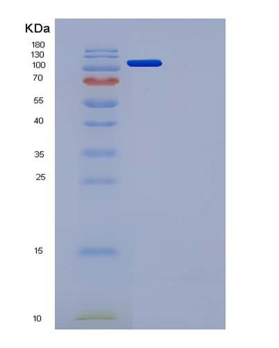 SDS-PAGE analysis of Mouse Flt4 (Vascular Endothelial Growth Factor Receptor 3) - Recombinant Protein, CAT# BLT-05017P, showing >95% purity under 15% SDS-PAGE (Reduced)Mouse Flt4 (Vascular Endothelial Growth Factor Receptor 3) - Recombinant Protein