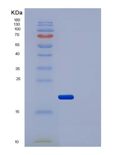 SDS-PAGE analysis of Human IL2RA (Interleukin-2 Receptor Subunit Alpha) - Recombinant Protein, CAT# BLT-05018P, showing >90% purity under 15% SDS-PAGE (Reduced)Human IL2RA (Interleukin-2 Receptor Subunit Alpha) - Recombinant Protein