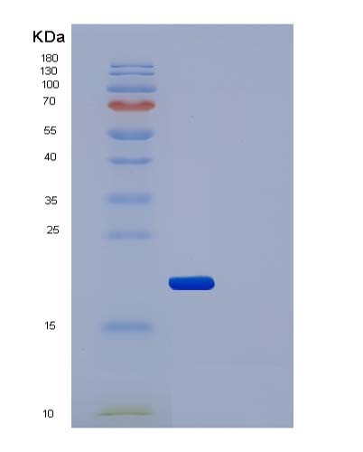 SDS-PAGE analysis of Human IL2RA (Interleukin-2 Receptor Subunit Alpha) - Recombinant Protein, CATHuman IL2RA (Interleukin-2 Receptor Subunit Alpha) - Recombinant Protein
