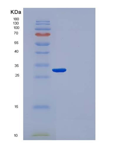 SDS-PAGE analysis of Human (Immunoglobulin Gamma-1 Heavy Chain) - Recombinant Protein, CAT# BLT-05753P, showing >85% purity under 15% SDS-PAGE (Reduced)Human (Immunoglobulin Gamma-1 Heavy Chain) - Recombinant Protein