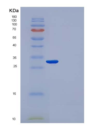SDS-PAGE analysis of Human (Immunoglobulin Gamma-1 Heavy Chain) - Recombinant Protein, CATHuman (Immunoglobulin Gamma-1 Heavy Chain) - Recombinant Protein