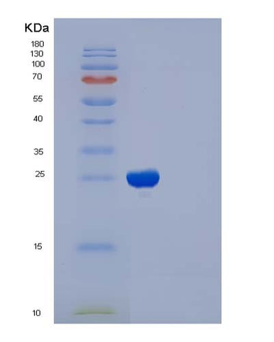 SDS-PAGE analysis of Human IL2RB (Interleukin-2 Receptor Subunit Beta) - Recombinant Protein, CAT# BLT-05022P, showing >85% purity under 15% SDS-PAGE (Reduced)Human IL2RB (Interleukin-2 Receptor Subunit Beta) - Recombinant Protein
