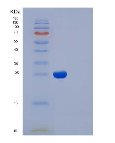 SDS-PAGE analysis of Human IL2RB (Interleukin-2 Receptor Subunit Beta) - Recombinant Protein, CATHuman IL2RB (Interleukin-2 Receptor Subunit Beta) - Recombinant Protein