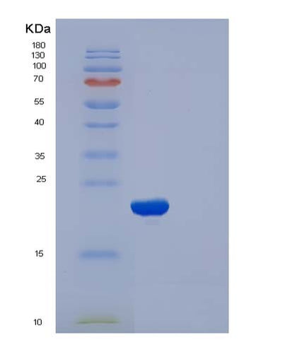 SDS-PAGE analysis of Human CFL2 (Cofilin-2) - Recombinant Protein, CAT# BLT-05023P, showing >90% purity under 15% SDS-PAGE (Reduced)Human CFL2 (Cofilin-2) - Recombinant Protein