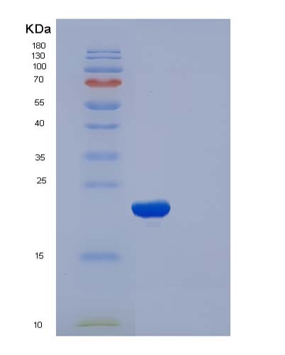 SDS-PAGE analysis of Human CFL2 (Cofilin-2) - Recombinant Protein, CATHuman CFL2 (Cofilin-2) - Recombinant Protein