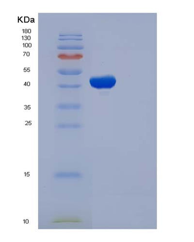 SDS-PAGE analysis of Human MAX (Protein Max) - Recombinant Protein, CAT# BLT-05028P, showing >90% purity under 15% SDS-PAGE (Reduced)Human MAX (Protein Max) - Recombinant Protein