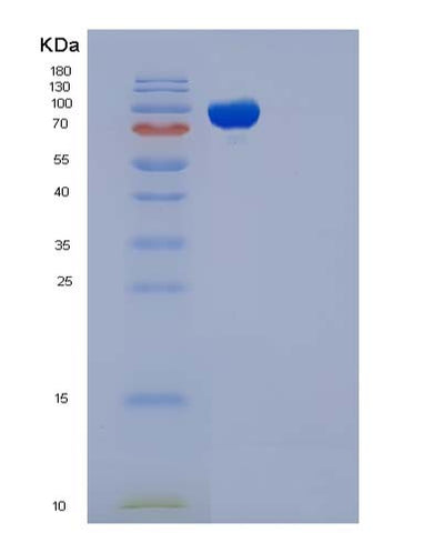 SDS-PAGE analysis of Human EED (Polycomb Protein Eed) - Recombinant Protein, CAT# BLT-05030P, showing >90% purity under 15% SDS-PAGE (Reduced)Human EED (Polycomb Protein Eed) - Recombinant Protein