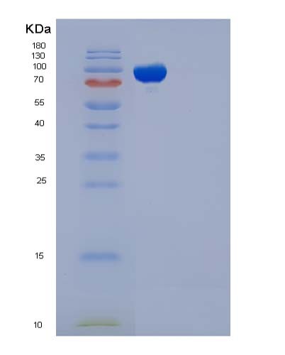 SDS-PAGE analysis of Human EED (Polycomb Protein Eed) - Recombinant Protein, CATHuman EED (Polycomb Protein Eed) - Recombinant Protein