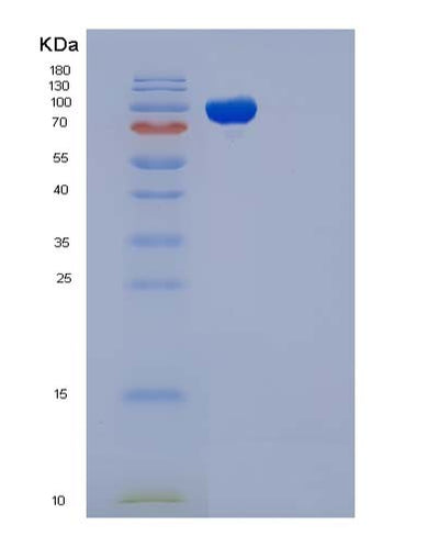 SDS-PAGE analysis of Mouse Icam1 (Intercellular Adhesion Molecule 1) - Recombinant Protein, CAT# BLT-05031P, showing >90% purity under 15% SDS-PAGE (Reduced)Mouse Icam1 (Intercellular Adhesion Molecule 1) - Recombinant Protein