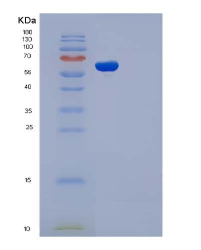 SDS-PAGE analysis of Human ADSL (Adenylosuccinate Lyase) - Recombinant Protein, CAT# BLT-05032P, showing >85% purity under 15% SDS-PAGE (Reduced)Human ADSL (Adenylosuccinate Lyase) - Recombinant Protein