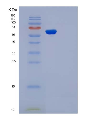 SDS-PAGE analysis of Human ADSL (Adenylosuccinate Lyase) - Recombinant Protein, CATHuman ADSL (Adenylosuccinate Lyase) - Recombinant Protein