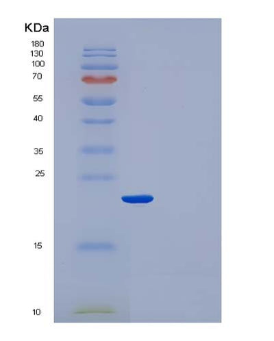 SDS-PAGE analysis of Human CRP (C-Reactive Protein) - Recombinant Protein, CAT# BLT-05036P, showing >95% purity under 15% SDS-PAGE (Reduced)Human CRP (C-Reactive Protein) - Recombinant Protein