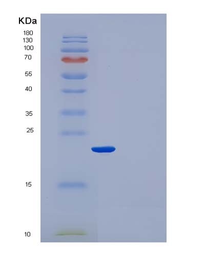 SDS-PAGE analysis of Human CRP (C-Reactive Protein) - Recombinant Protein, CATHuman CRP (C-Reactive Protein) - Recombinant Protein