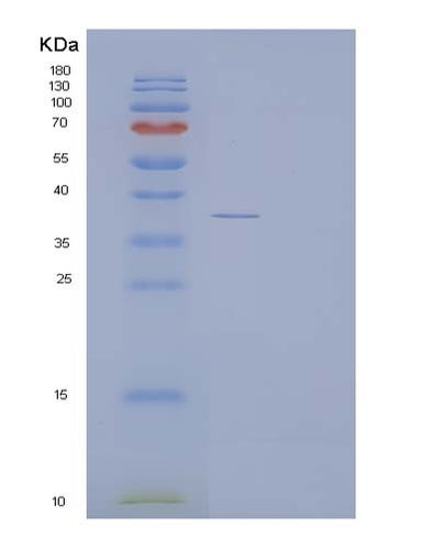 SDS-PAGE analysis of Human ACYP1 (Acylphosphatase-1) - Recombinant Protein, CAT# BLT-05039P, showing >95% purity under 15% SDS-PAGE (Reduced)Human ACYP1 (Acylphosphatase-1) - Recombinant Protein
